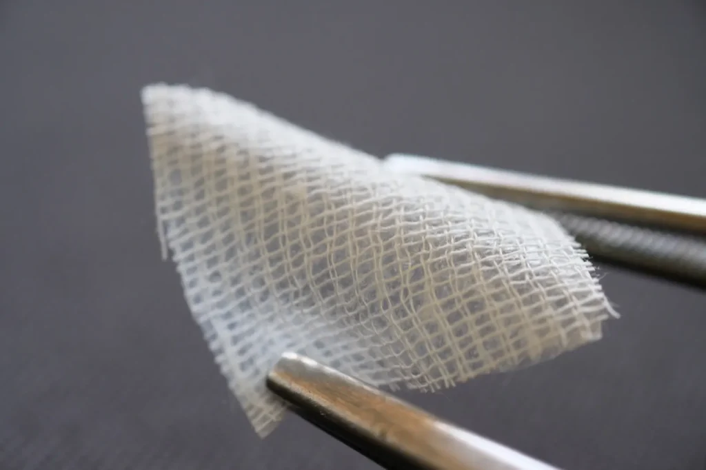 Bioengineered skin substitute