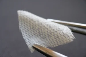 Bioengineered skin substitute