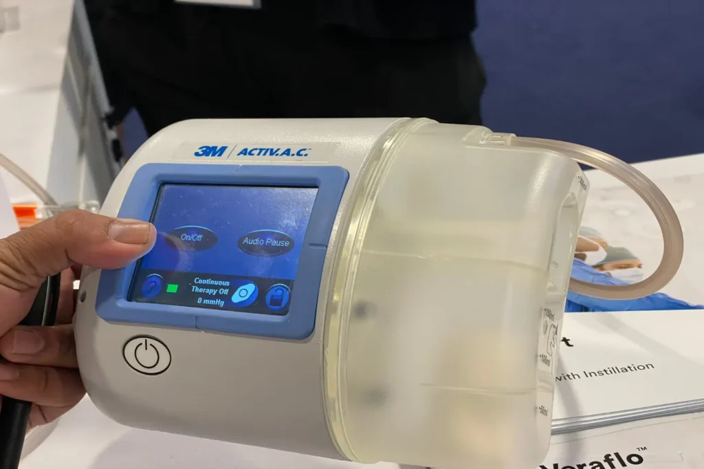 Negative Pressure Wound Therapy